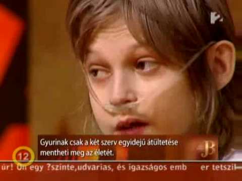 ivott egy pirulát férgek számára, és beteg a férgek megfelelő kezelése felnőtteknél