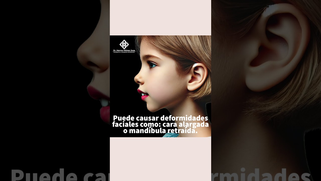 Marcos Gómez Sosa-79