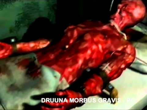 druuna morbus gravis