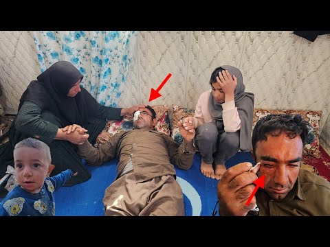 😳👁 Mirza's third operation on her eye ... and the joke that turned everything upside down.