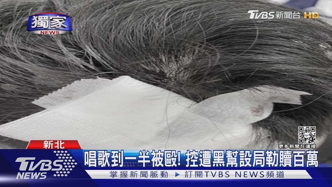 唱歌到一半被毆！　控遭黑幫設局勒贖百萬