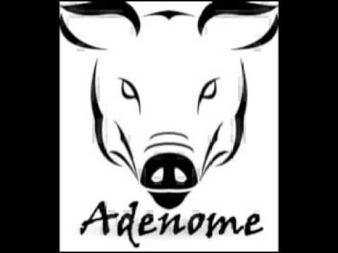 Adenome - Doux Jeyse (Dirty electro Mix)
