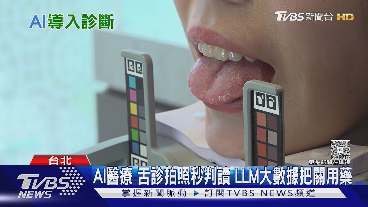 AI醫療 舌診拍照秒判讀 LLM大數據把關用藥