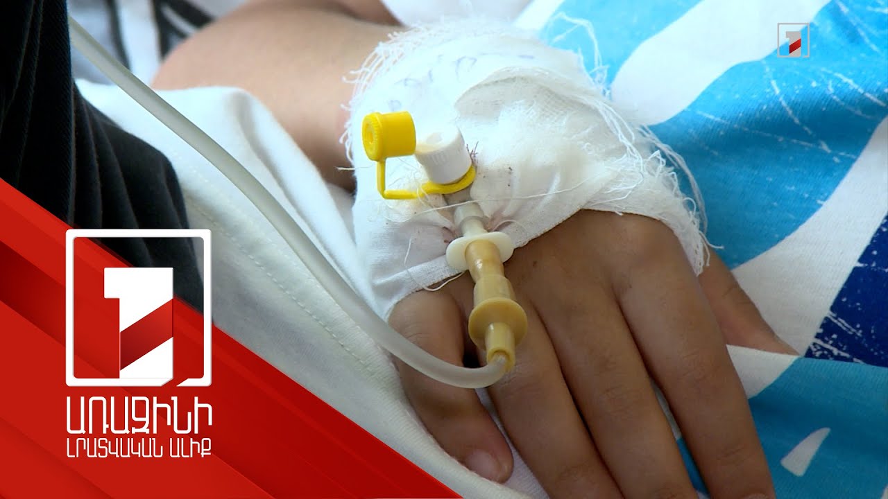 Էնտերովիրուսային հիվանդությունների ակտիվացման պատճառներն ու հակազդման միջոցները