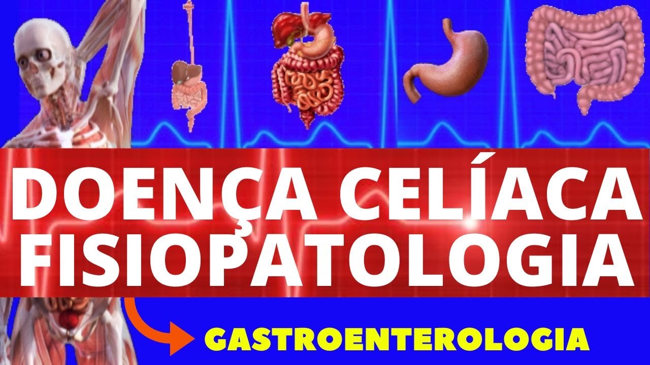 DOENÇA CELÍACA - FISIOPATOLOGIA (COMO OCORRE A DOENÇA CELÍACA) - GASTROENTEROLOGIA