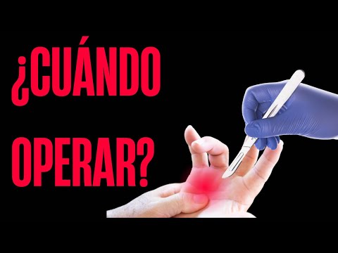 Dedo enganchado. Consejos de un cirujano.