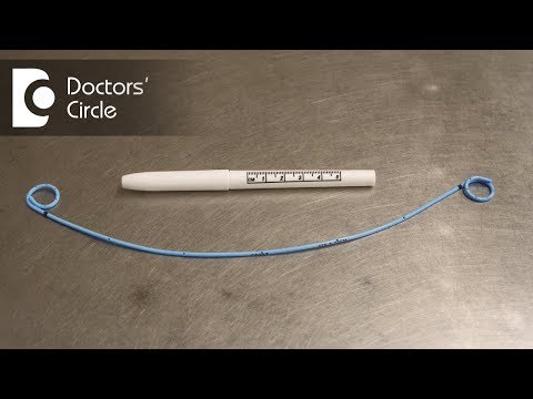What is a Ureteral Stent How is a Stent placed & removed?- Dr. Santosh Bethur