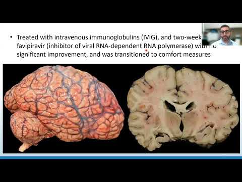 AANP Teaching Rounds - September 22, 2025 - Emerging Viral Infections