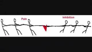 preview picture of video 'Orem Chiropractor Discusses How Brain Lateralization Causes Pain'
