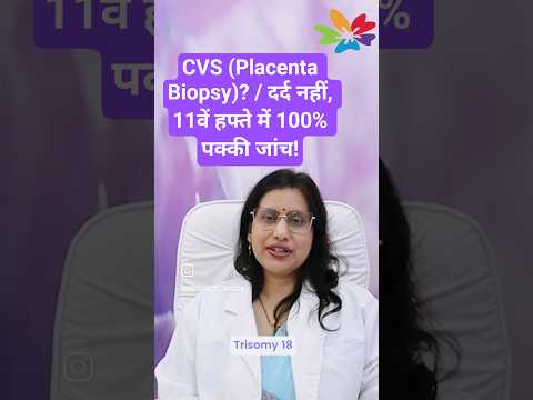 CVS test — why and how at 11-14 weeks