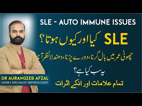 SLE Disease | SLE Symptoms In Urdu | Early Age SLE  - Systemic Lupus Erythematosus Treatment