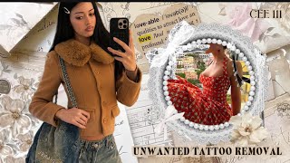 unwanted tattoo removal