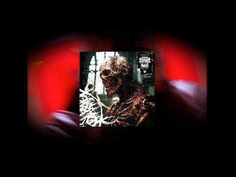 Video thumbnail for ANOMALIE