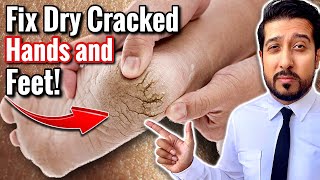 How to Fix DRY and CRACKED Hands and Feet | 5 Best Creams for Dryness