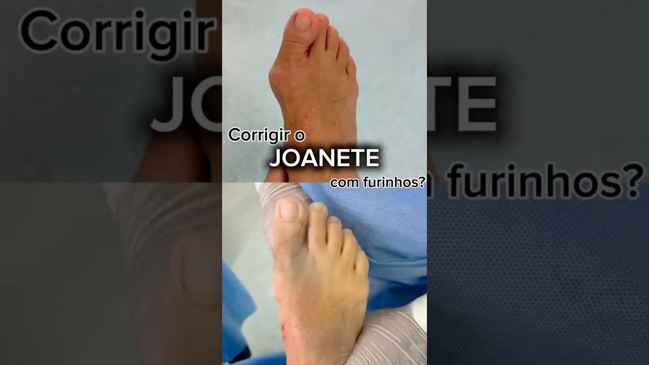 Pedro Felipe Araújo De Paula Santos-8