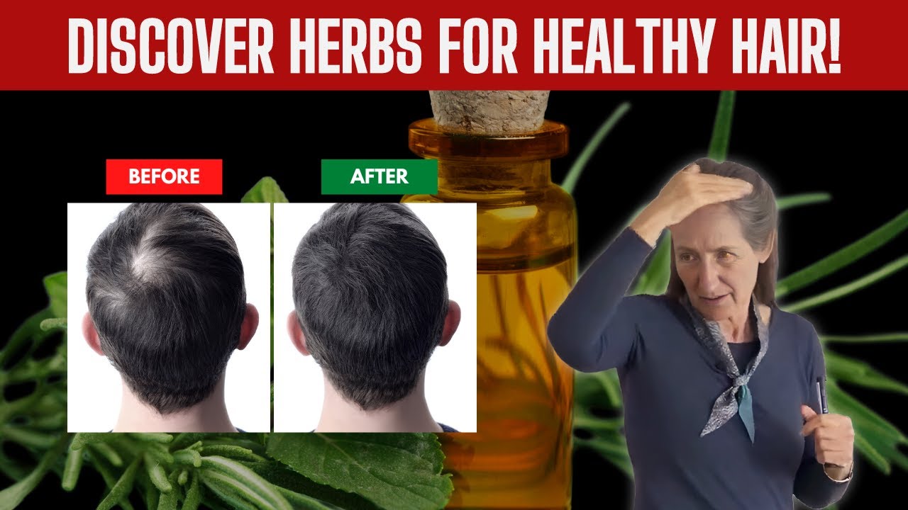 Herbal Remedies for Scalp Problems and Hair Loss | Barbara O'Neill