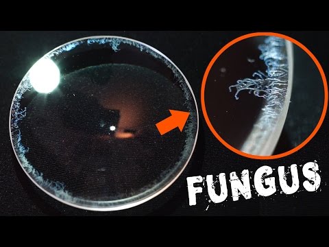 How to Remove Fungus from a Camera Lens FAST & EASY
