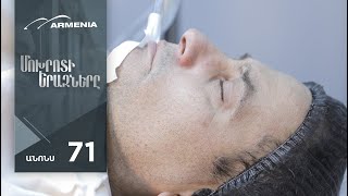 Մոխրոտի Երազները, Սերիա 71, Անոնս / Mokhroti Eraznery