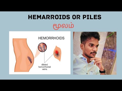 HEMORRHOIDS OR PILES // மூலம்♂️♀️ #piles #electropathy #medication #doctors #studies #study #மூலம்