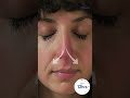 Breathe Your Best With Otrivin