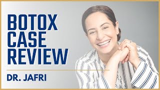 Botox: Case Review | Dr. Jafri