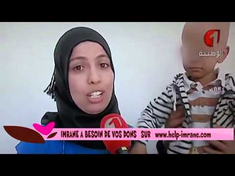 comment financer une greffe de cheveux