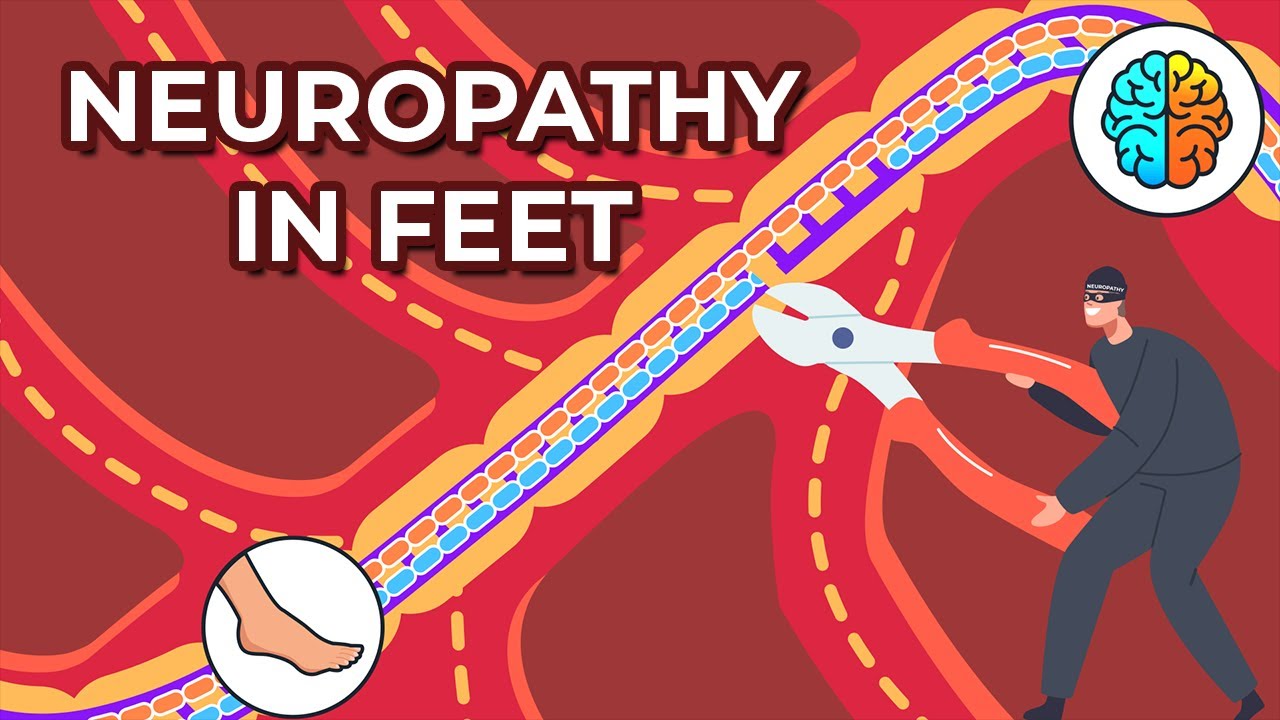 Dealing with Neuropathy in Feet: Causes, Symptoms, and Treatments