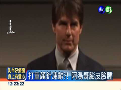 阿湯哥被爆打童顏針 月亮臉回春