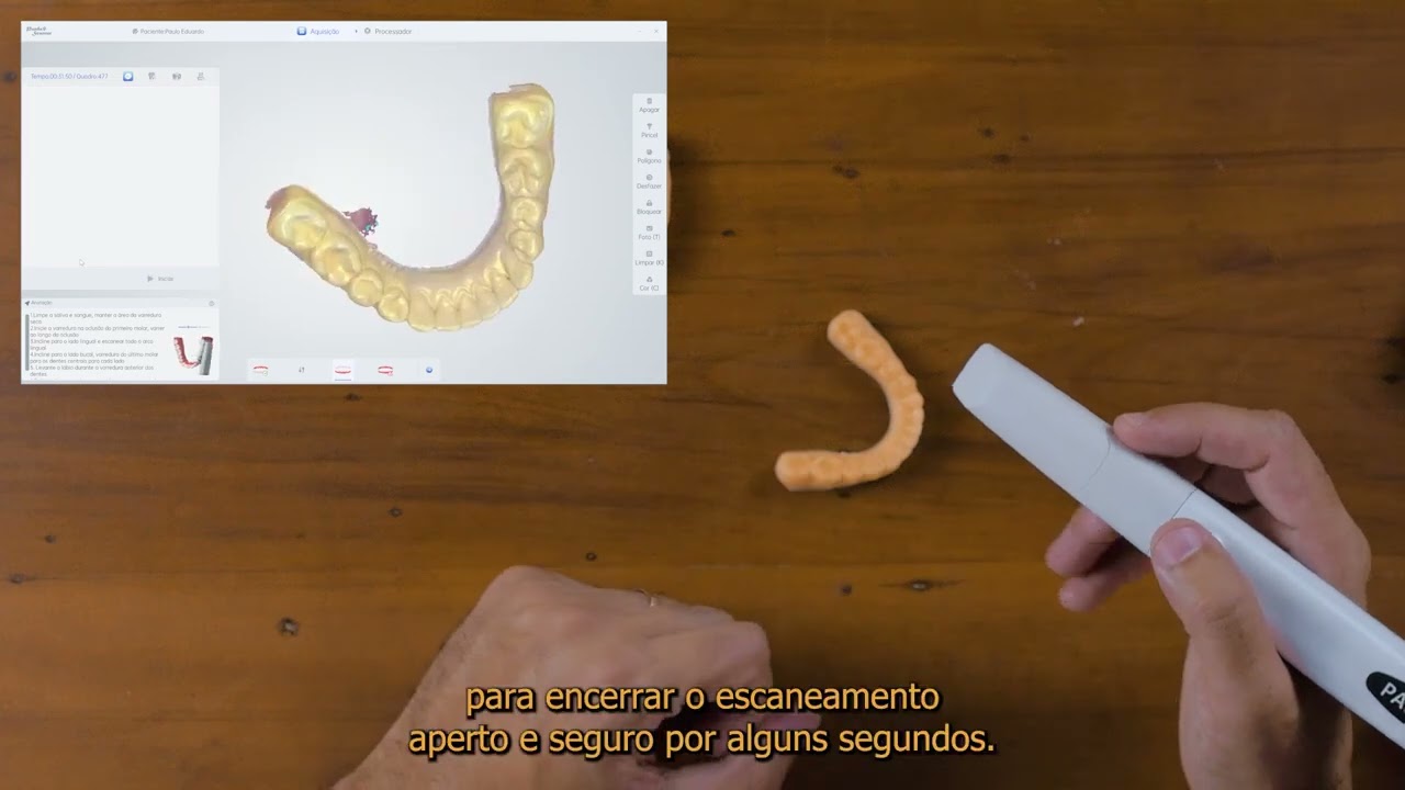 Vídeo 19 - Como realizar um escaneamento clínico