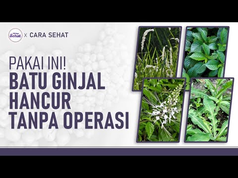 Cara Alami Meluruhkan Batu Ginjal, Tanpa Operasi! | Hidup Sehat tvOne