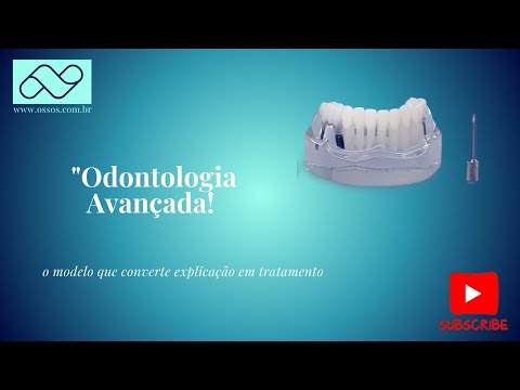MANDÍBULA ACRÍLICA COM DENTES E 3 IMPLANTES - cód. 9570