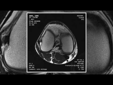 Ados - Woda (Prod. TSKSOMD)