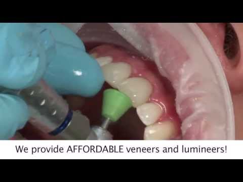 Dental Clinic Nogales | Save 50-70% on Root Canal Fillings Dentures Crowns Cosmetic Dentist Services