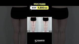 “허벅지 실루엣, 허벅지 틈..이 정도까지 차이 남?”