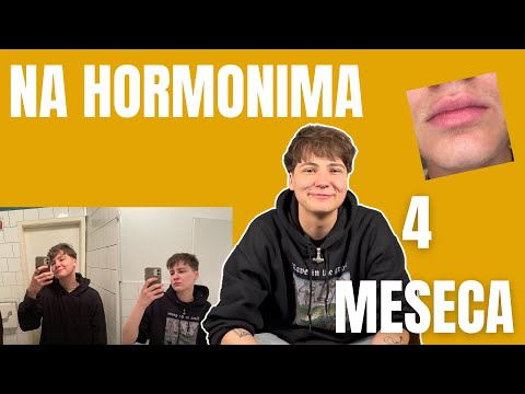 ČETVRTI MESEC NA T - FTM TRANZICIJA | TRANSRODNOST