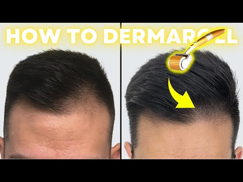 How to Derma Roll for Quickest Hair Results (Step-by-Step Guide)