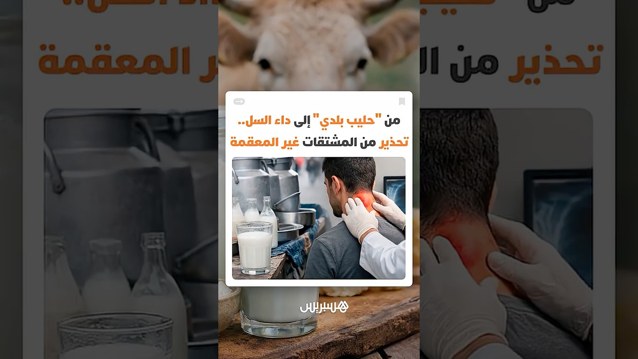 أمراض تبدأ من كوب "حليب بلدي" إلى خطر داء السل.. تحذير من المشتقات الحليبية غير المعقمة thumbnail