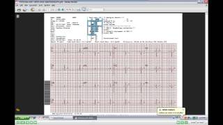 Allscripts Enterprise and Professional Videos