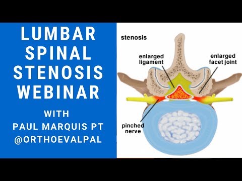 L4 Nerve Root Compression Evaluation with Paul Marquis PT