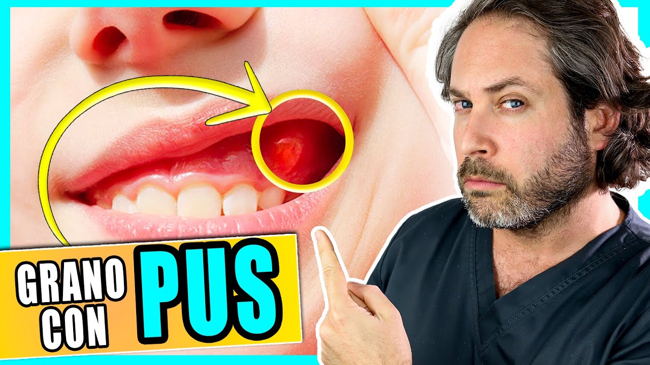 Juan Carlos Sánchez Pérez-40