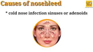 Nose Bleeding