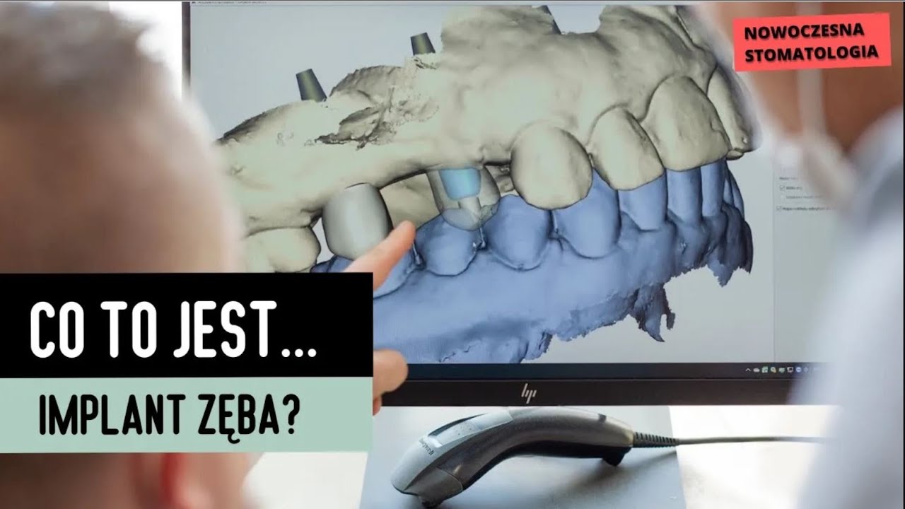 Łukasz Wojszwiłło-39