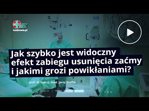 Jak szybko jest widoczny efekt zabiegu usunięcia zaćmy i jakimi grozi powikłaniami?