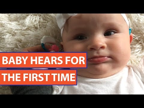 Baby Wears Hearing Aids For First Time Video 2017 | Daily Heart Beat
