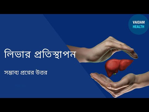 লিভার প্রতিস্থাপন -প্রায়শই জিজ্ঞাসিত প্রশ্ন