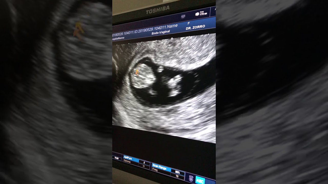 Carlos Andres Zorro Rodriguez-28