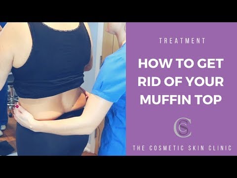 How To Get Rid Of Your Muffin Top With CoolSculpting 