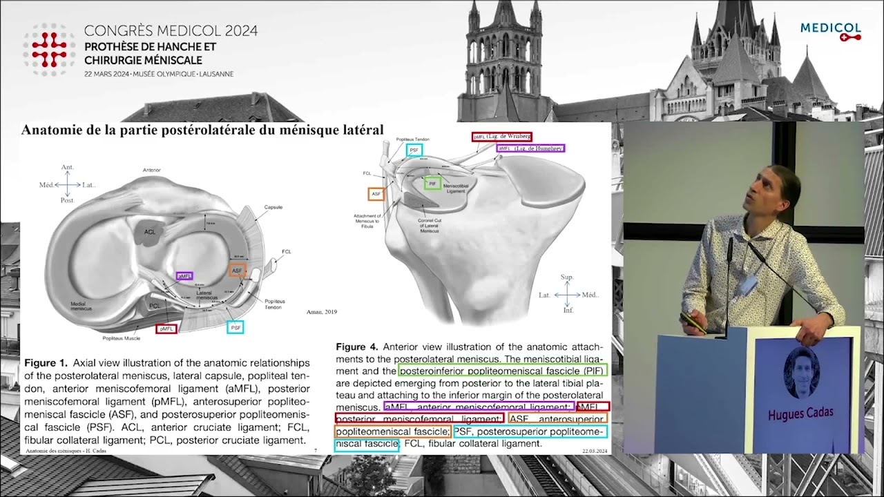 Anatomie des ménisques - Hugues Cadas