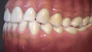 Low Poly Teeth and Gums video thumbnail