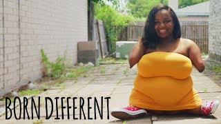 Living Without Hands – And I Couldn’t Be Happier | BORN DIFFERENT